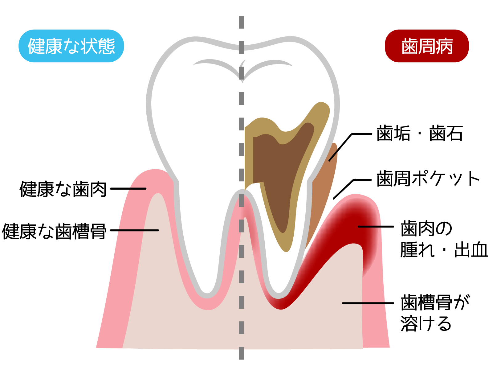 お口のケアは乱れていませんか?